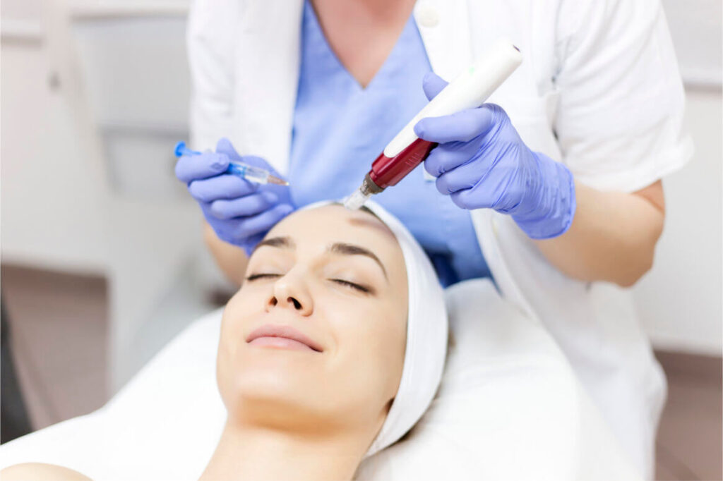 How long does it take for microneedling to work?