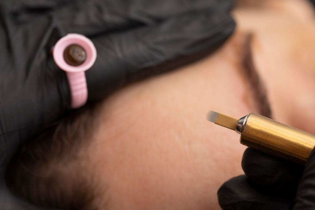 Microneedling with exosomes in Beverly Hills