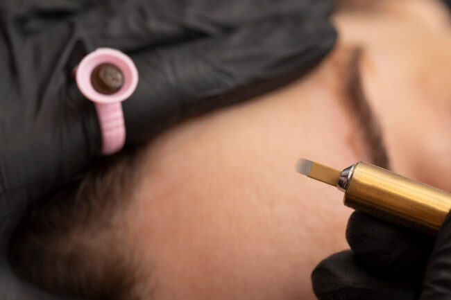 Microneedling with exosomes in Beverly Hills